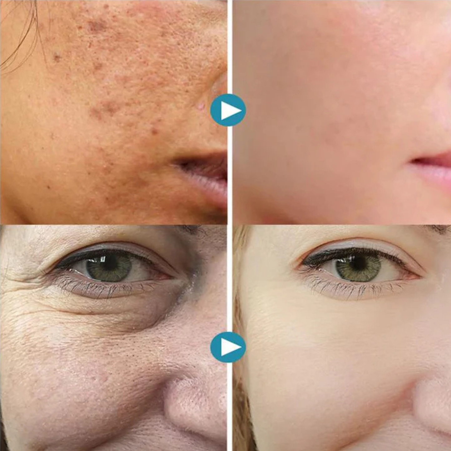 Purelle™ Pore-Perfecting Cream inspired by South Korea