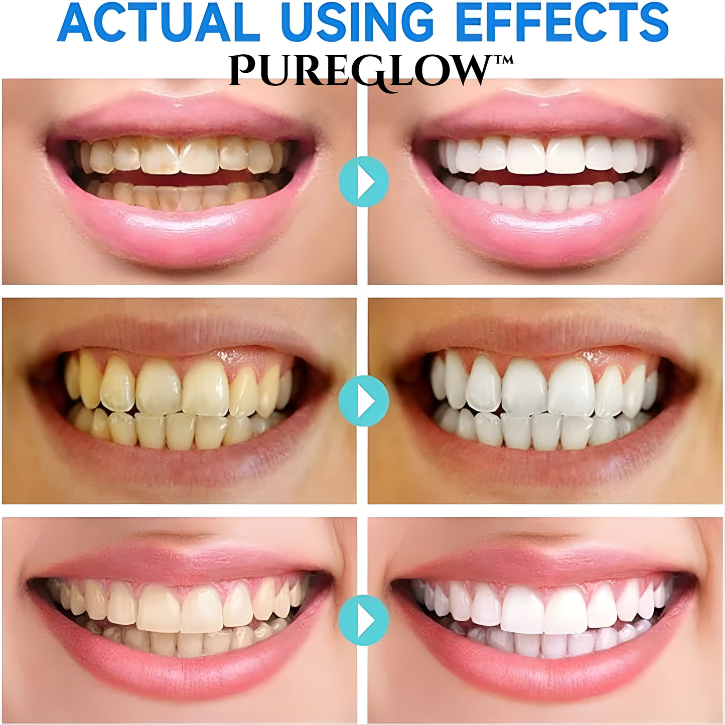 PureGlow™ Instant Niacinamide Whitening Toothpaste